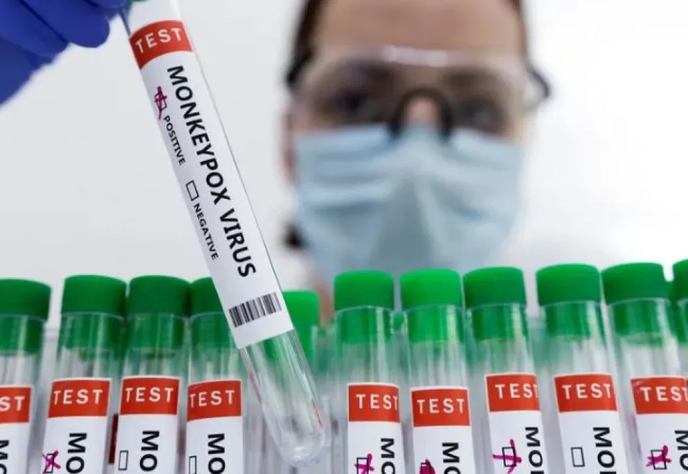 Viruela del mono: hubo acuerdo para distribuir la vacuna en América Latina