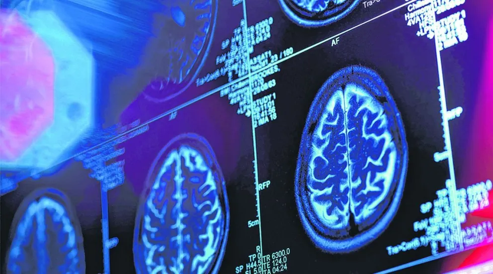 Descubren una nueva estructura cerebral relacionada con el miedo