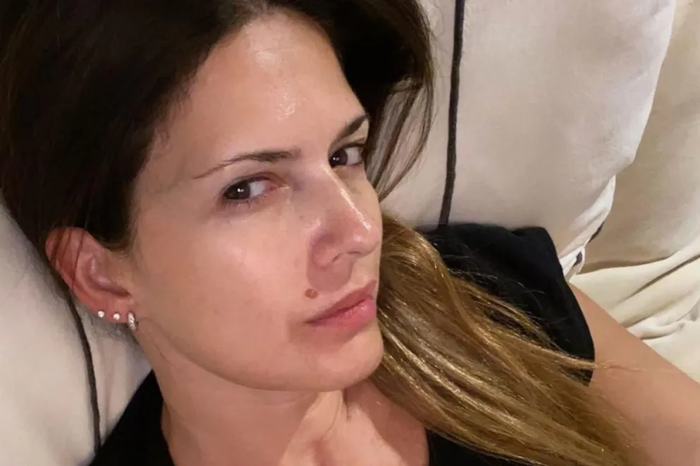 Isabel Macedo tuvo un accidente y mostró su cicatriz 
