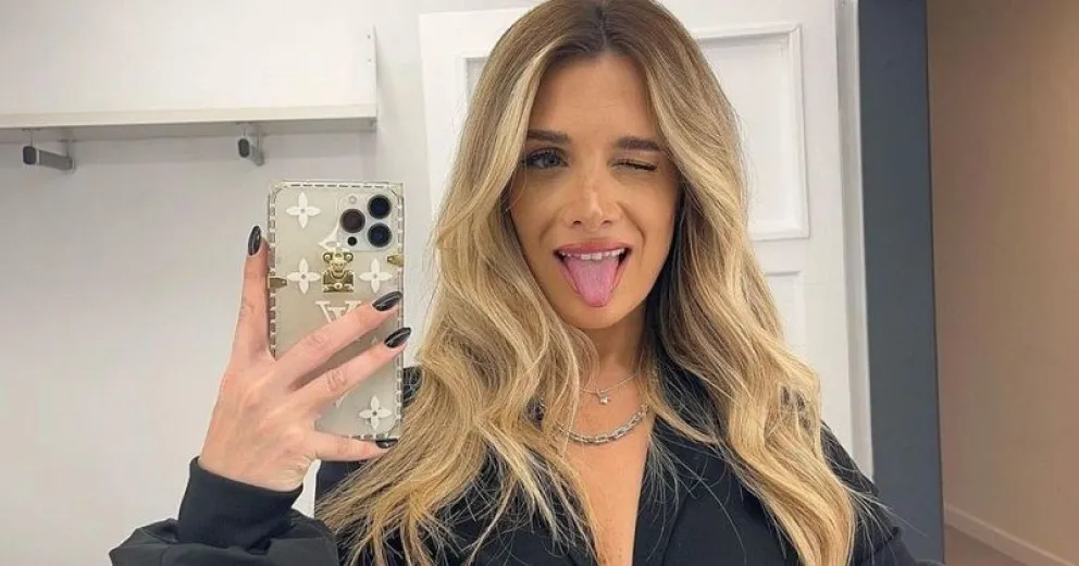 El nuevo retoque estético de Camila Homs que impactó 