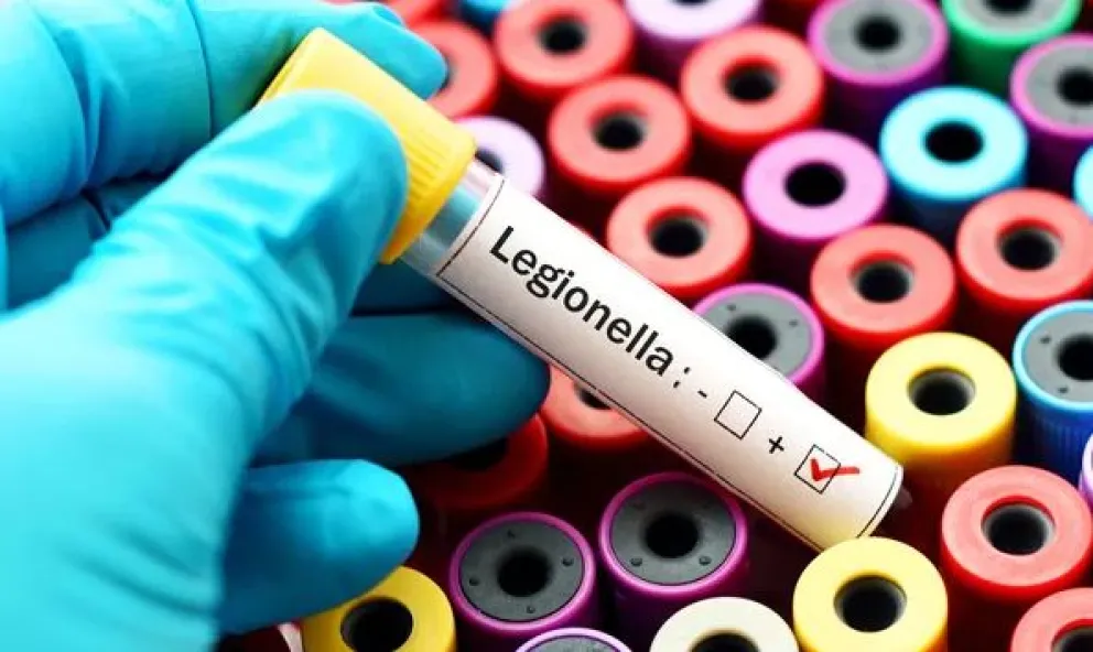 Qué es la Legionella: la bacteria que ya causó 4 muertes en Tucumán 
