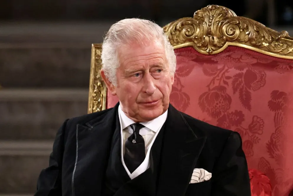 Conoce el problema que hace que el Rey Carlos III tenga las manos rojas e hinchadas