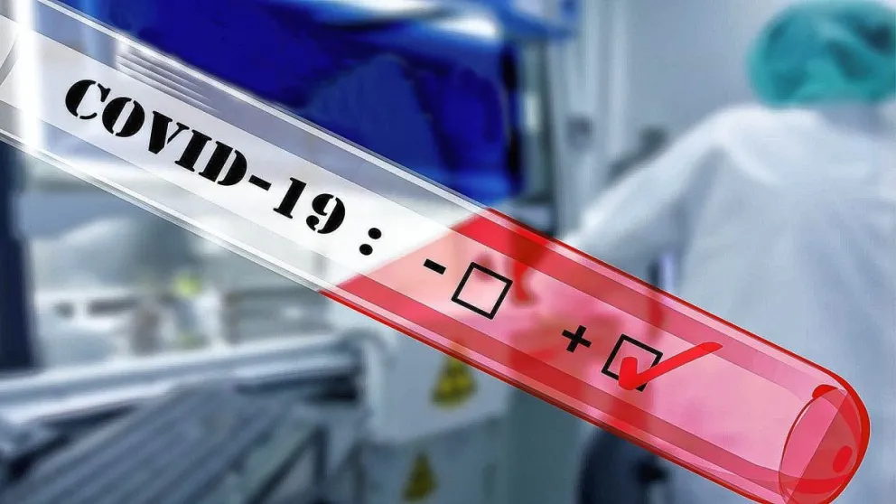 Chubut sumó 17 nuevos contagios de covid