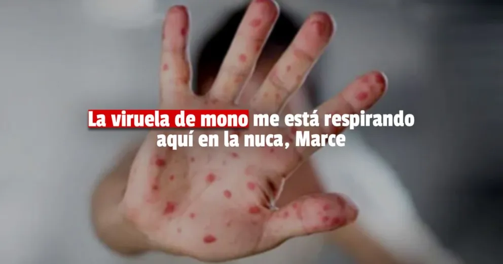Viruela del mono: confirmaron 3 nuevos casos y se eleva a 12 la cifra total en Argentina