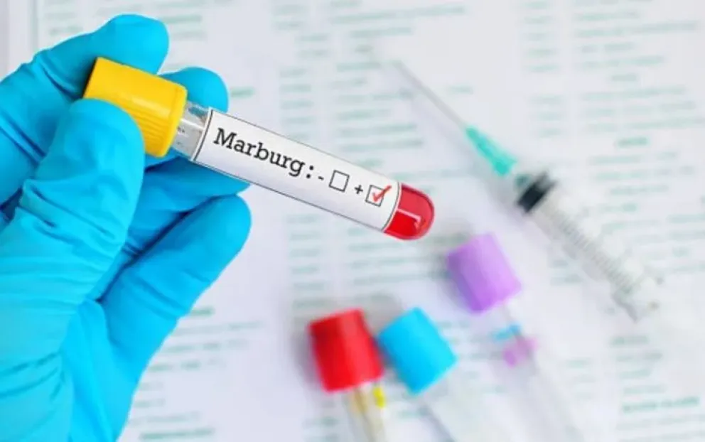 Qué es el virus de Marburgo: la enfermedad que te deja "aspecto de fantasma" y puso en alerta a la OMS