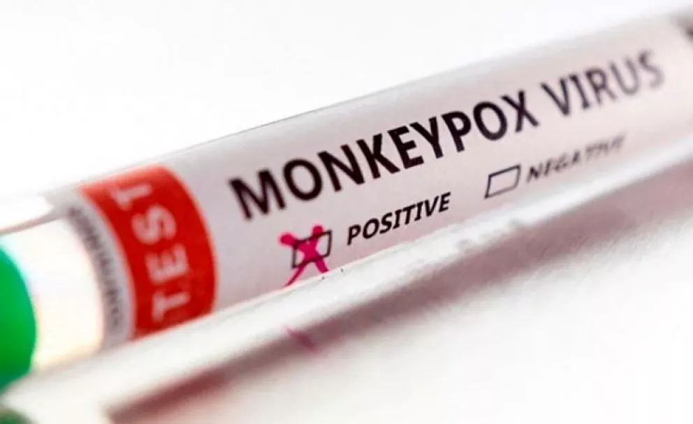 El regulador europeo de medicamentos aprobó una vacuna contra la viruela del mono