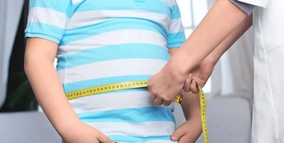 obesidad 