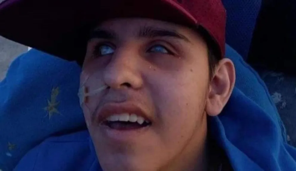Joven necesita ayuda para un tratamiento: semanas atrás le robaron la recaudación de un evento solidario