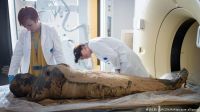 Nuevo hallazgo: científicos descubrieron la primera momia embarazada que murió de cáncer