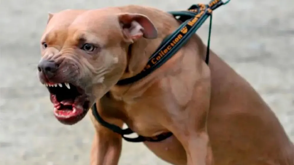 Tragedia: un pitbull mordió la cara de una beba ferozmente y tuvieron que darle 50 puntos