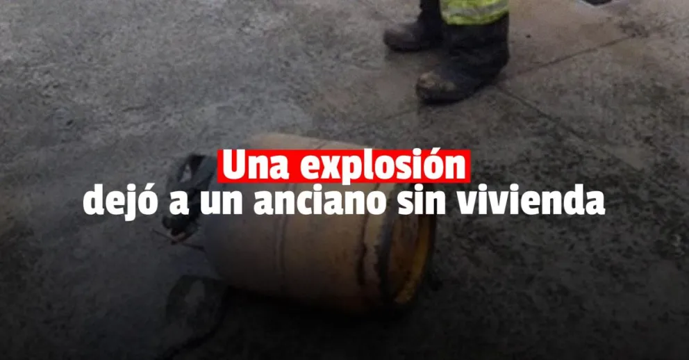 Un hombre sufrió quemaduras luego de que se le incendiara la casa