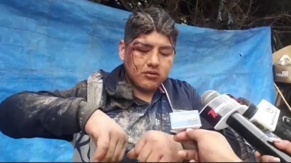Fue a una fiesta de la Pachamama y se despertó dentro de un ataúd, enterrado como ofrenda
