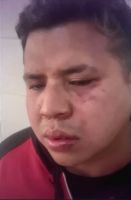 Denuncia que patovicas agredieron brutalmente a su hijo con discapacidad