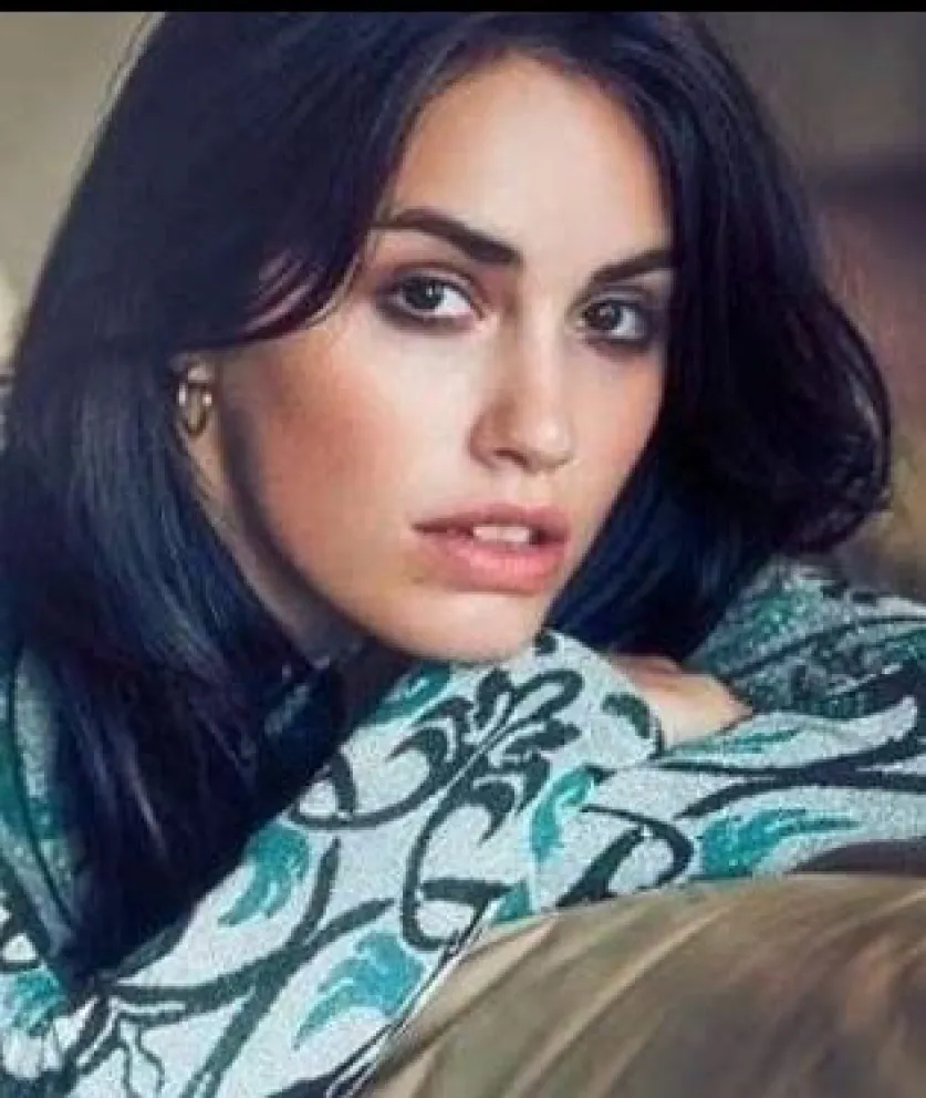 Lali Espósito se realizó un tratamiento: conocé de qué se trata 