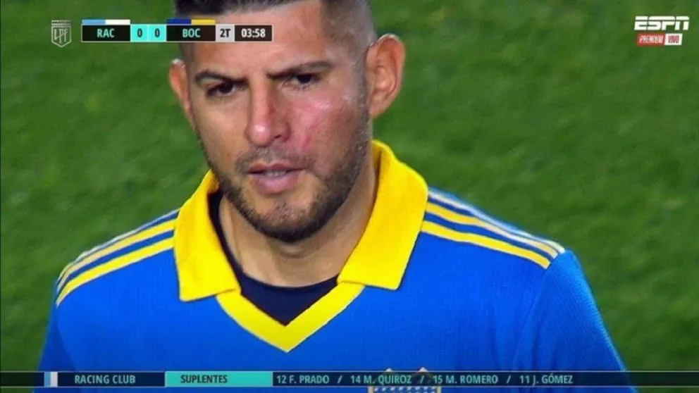 Las palabras de Carlos Zambrano tras la pelea con Darío Benedetto