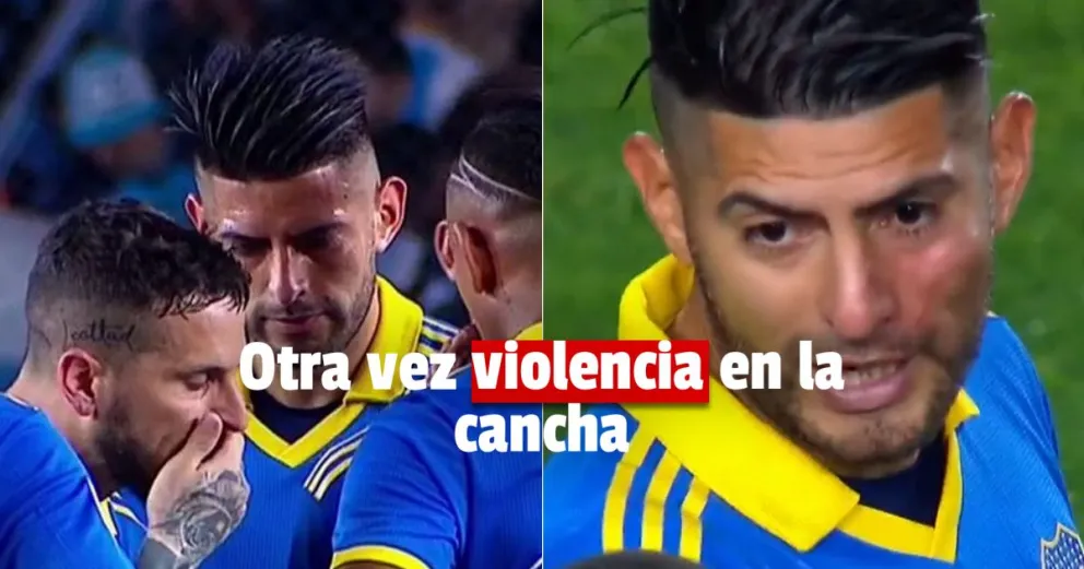 El partido de Boca terminó con trompadas y rasguños entre dos jugadores 