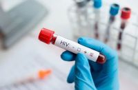 Investigadores argentinos hicieron un importante descubrimiento sobre el VIH