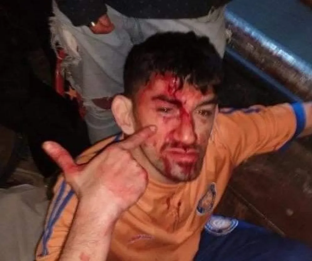 AHORA: Incidentes a la salida del clásico de Roca