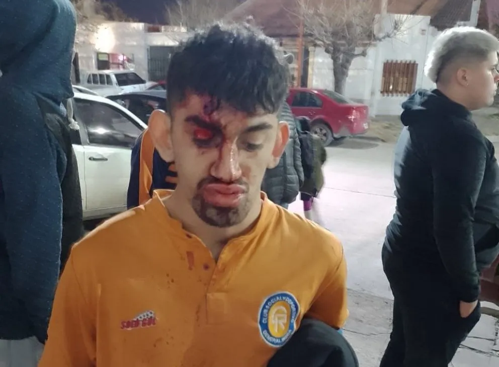 Violencia en el clásico de Roca: Un joven terminó con una herida profunda en la cabeza