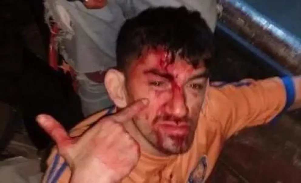 Una mancha en el deporte con dos hinchadas que se enfrentaron tras un clásico regional