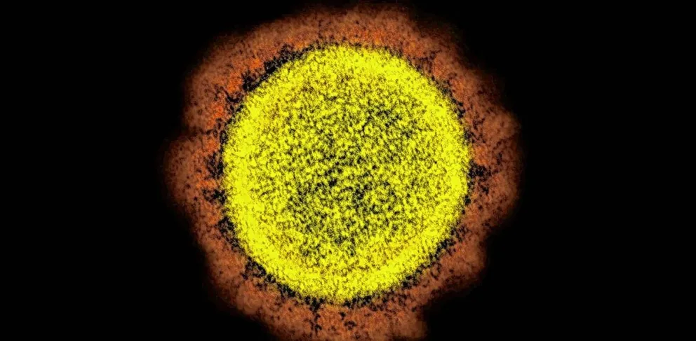Detectan una súper variante de coronavirus y ya hay preocupación en la comunidad científica