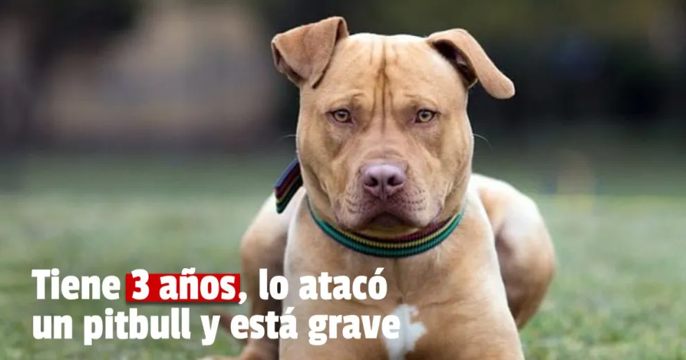 Caucete: un niño de 3 años fue atacado por un pitbull y está grave